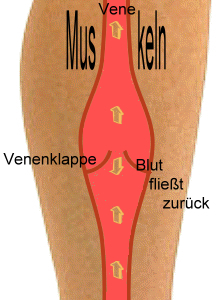 Nicht schließende Venenklappen (ohne Kompressionsstrupf)